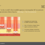 About Xerf Skin Tightening Page 1