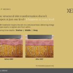 About Xerf Skin Tightening Page 5