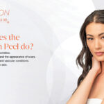 eCO2-3D What Does Precision Peel Do?