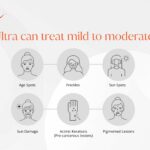 Ultra can treat mild to moderate: