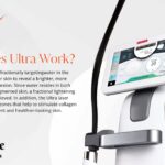 How does Ultra Work?